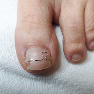 Cursus Nagelbeugeltechnieken + KRP
